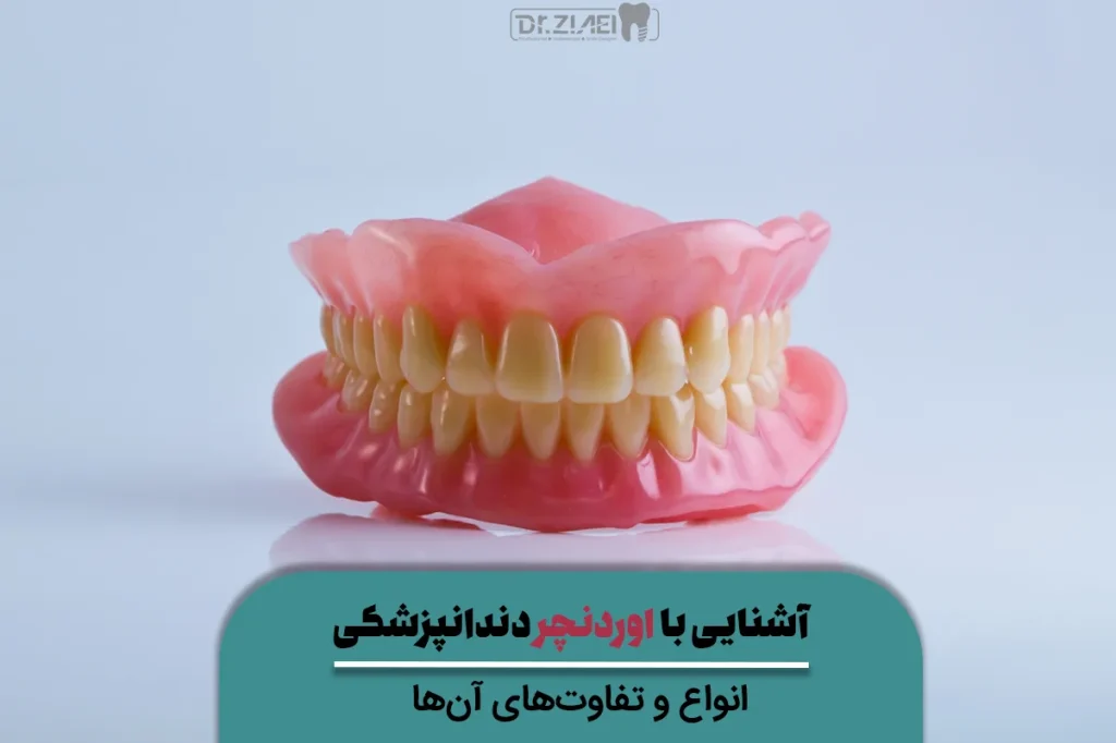انواع اوردنچر دندانپزشکی