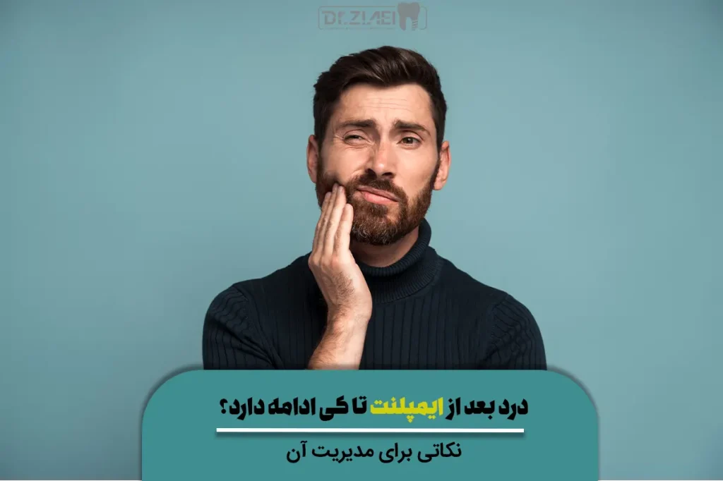 درد بعد از ایمپلنت تا کی ادامه دارد؟ نکاتی برای مدیریت آن