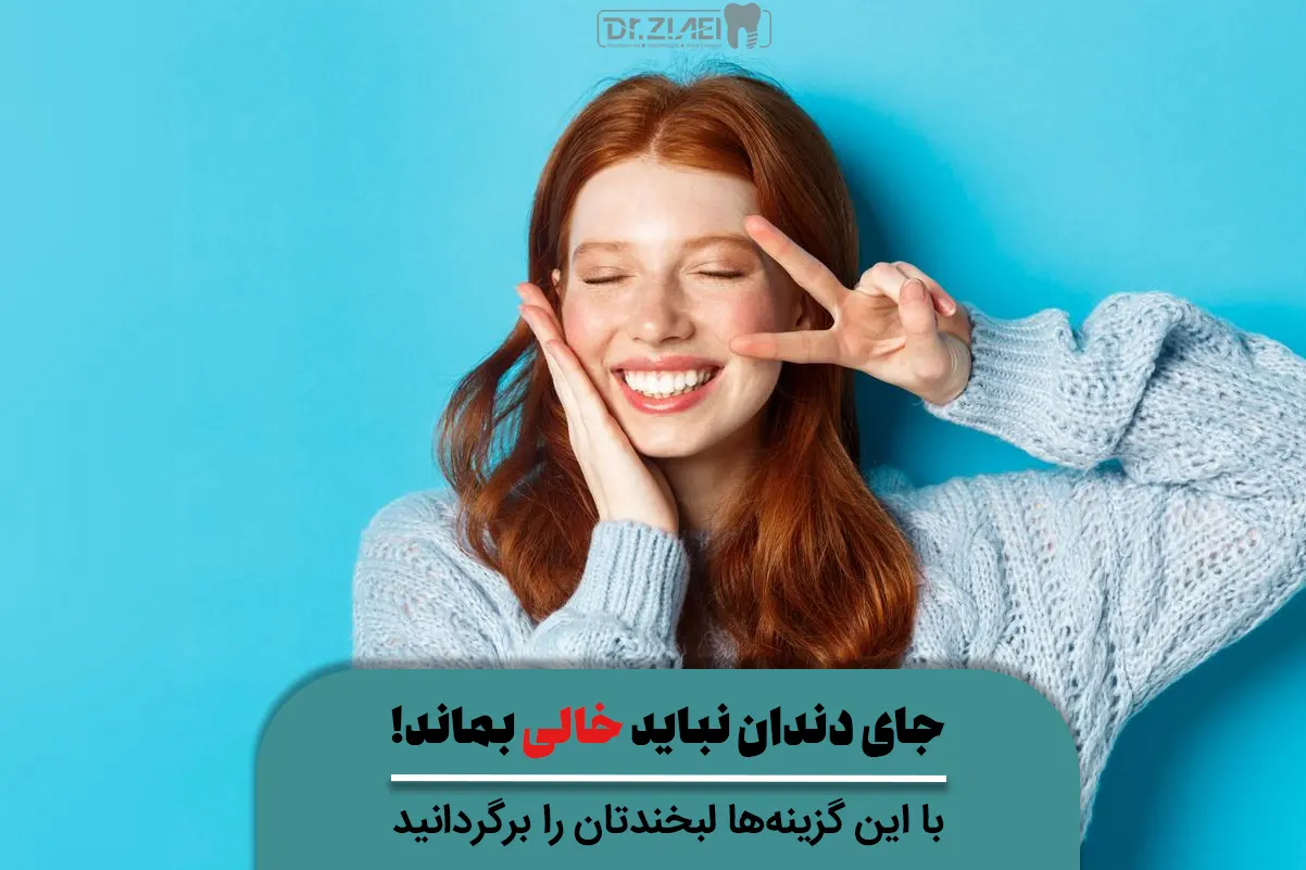 جای دندان نباید خالی بماند! با این گزینه‌ها لبخندتان را برگردانید