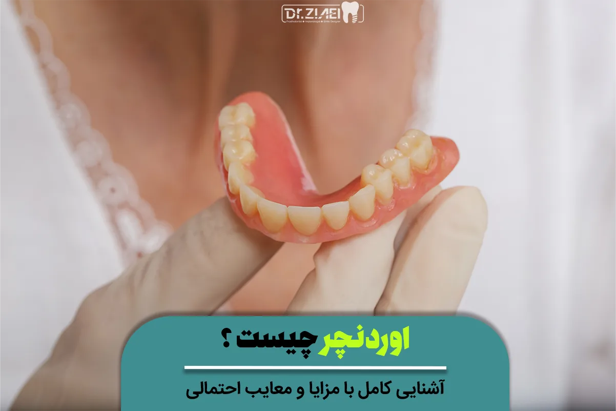 اوردنچر چیست و چه معایب و مزایایی دارد؟