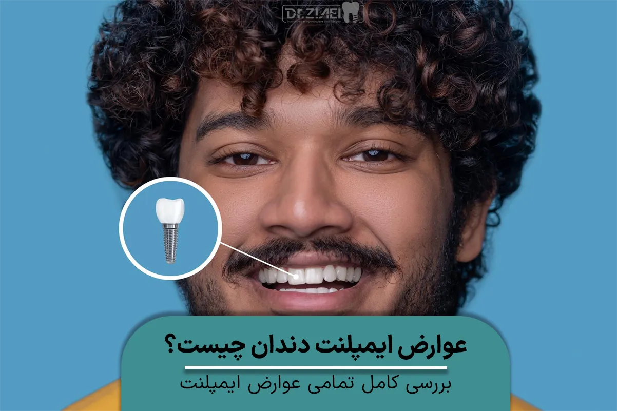 عوارض ایمپلنت دندان