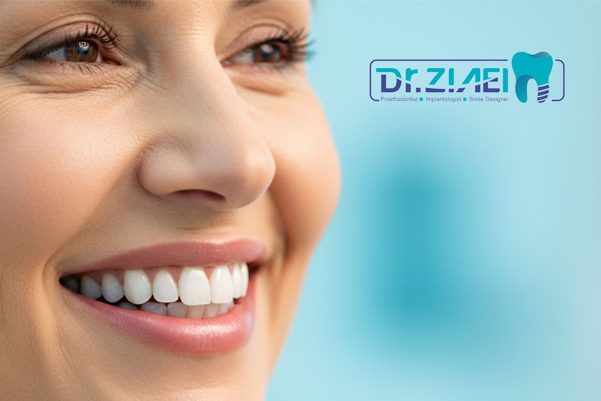 دندانهای پوسیده و از دست رفته؟ 7 دلیل برای انتخاب ایمپلنت دندان