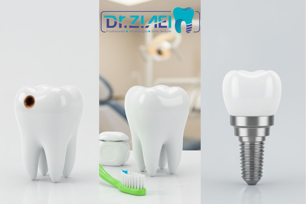 چرا دندان‌هایمان پوسیده می‌شوند؟